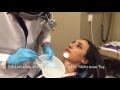 After Rhinoplasty - Volume 2: Removing Silicons