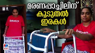 മരണപ്പാച്ചിലിന് കൂടുതല്‍ ഇരകള്‍; സന്ധ്യാ റാണിക്ക് കാല്‍ നഷ്ടമായി |Sandhya Rani |Vizhinjam