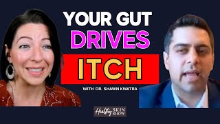 Why You're So Itchy (HINT: It's Probably Not Histamine) | Dr. Shawn Kwatra