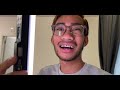 vlog aku pakai braces 😬