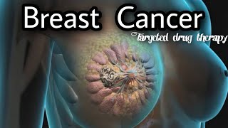 Metastatic breast cancer ,, Targeted drug therapy ,, Treatment of breast cancer •|