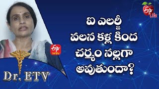 ఐ ఎలర్జీ వలన కళ్ళ కింద చర్మం నల్లగా అవుతుందా? | డాక్టర్ ఈటీవీ  | 14th నవంబర్ 2022 | ఈటీవీ  లైఫ్