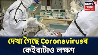 Coronavirusত আক্ৰান্তৰ সন্দেহ Dibrugarhৰ এজন যুৱক