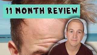 11 months after my hair transplant | Dr Cinik | Review