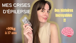 MES CRISES D’ÉPILEPSIE | épilepsie myoclonique juvénile