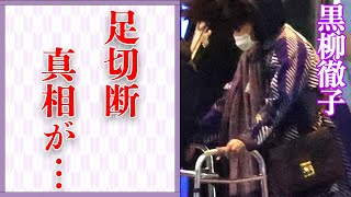 黒柳徹子が“足切断”間近となった“大怪我”や“難病”の真相に言葉を失う…「徹子の部屋」でも有名な女優の“隠し子”の正体に驚きを隠せない…