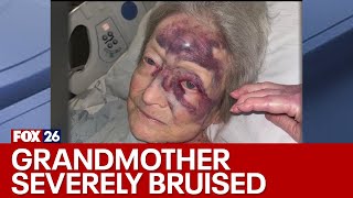 Houston woman claims grandmother beaten, bruised at nursing home