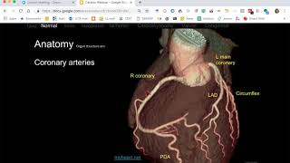 Cardiac Radiology USMLE content list