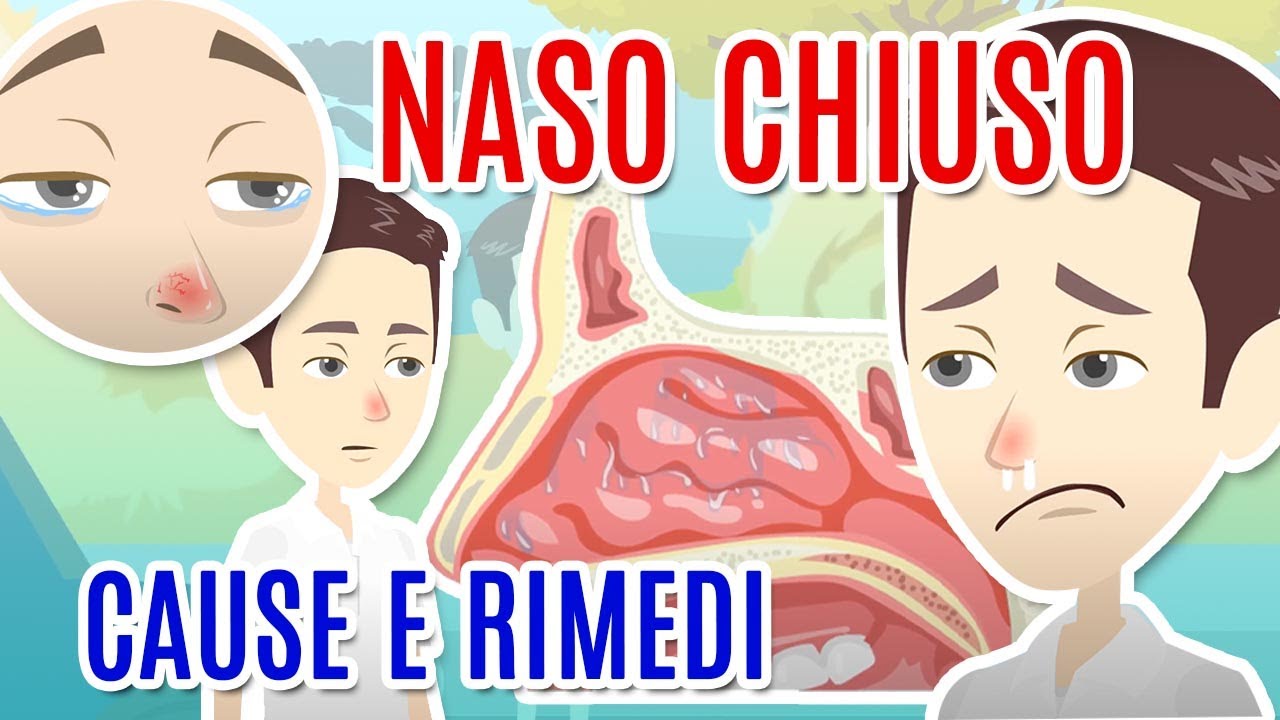 NASO CHIUSO: Cause, Diagnosi E Cure Per La CONGESTIONE NASALE - YouTube