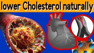 How to lower your Cholesterol naturally