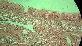 ciliated epithelium