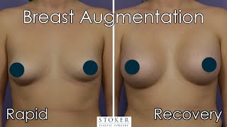 Rapid Recovery Breast Augmentation Los Angeles - Gummy Bear Breast Implants