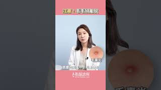 除毛習慣徒手拔毛?！ 醫師提醒要注意  #shorts