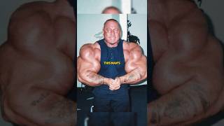 Greg Valentino, the man who’s arms exploded #synthol #bodybuilding