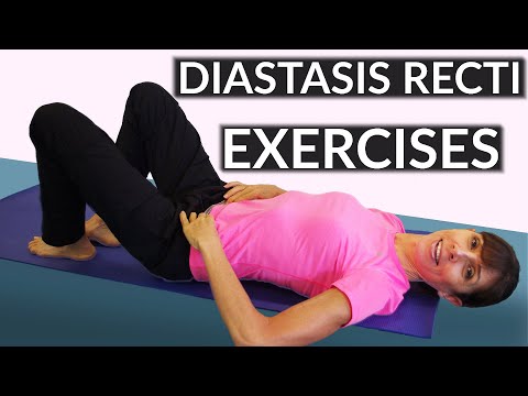 Diastasis Recti Exercises - Physical Therapy Diastasis Repair Exercises ...