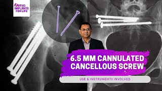 6.5mm Cannulated Cancellous Screws Related Instruments \u0026 Uses