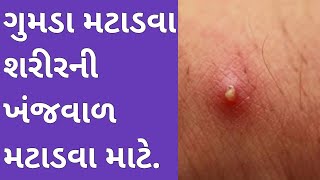 મુંઢ ગુમડા ,ફોલ્લા,સાદા ગુમડા વગેરે મટાડવા માટેનો અકસીર ઇલાજ | આયુર્વેદિક ઉપચાર | gumda no ilaj |