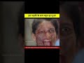 Sad story of the acid victim girl | acid attack #shorts #acid attack