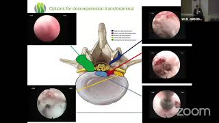 Endoscopy Basics   Ralf Wagner