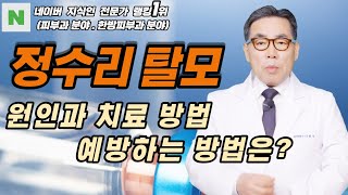 4K)정수리 탈모 증상은 몸에 열이 많아서 발생하는 증상이 아닙니다.