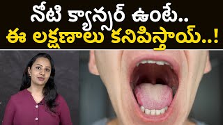 What are the first signs of Cancer in the Mouth||Samayam Telugu