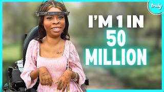 I Have 15 Screws In My Head To Straighten My Spine | BORN DIFFERENT