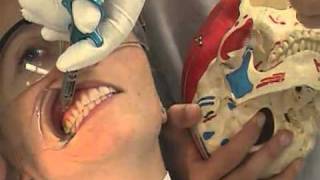 The Vazirani-Akinosi closed mouth mandibular block