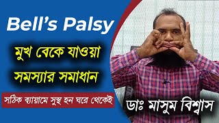 Bell's/Facial Palsy কি এবং কেন হয়?  মুখ বাকা রোগের সঠিক চিকিৎসা বা ব্যায়াম  | Dr Masum Biswas