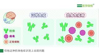 多灶性运动神经病复发了怎么办？