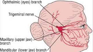 Migraine Headache Relief Music: TMJ Pain Relief Binaural Beats Frequency
