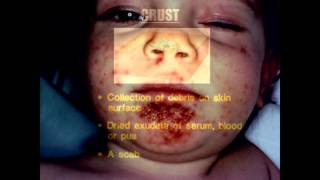 Cutaneous Manifestations of Systemic Disease by Dr. Kevin T. Belasco