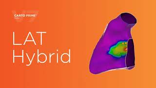 CARTO 3 Version 7: LAT Hybrid mapping