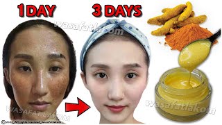 Magical Turmeric Cream | In 3 days it removes pigmentation, dark spots, freckles and treats melasma