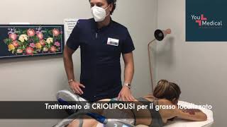 Trattamento di Criolipolisi per il grasso localizzato - You Medical