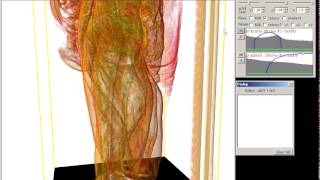 VoTracer 1D / 2D transfer functions for volume rendering