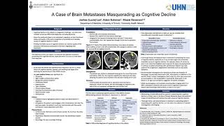 Poster #30 – Juehea (Lucia) Lee – “A case of brain metastases masquerading as cognitive decline”