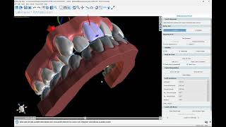 BSP4.10: Generating an Aligner Trim Curve for Automatic Aligner Trimming