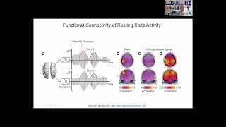 Spatial resolution (leakage) and connectivity