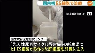 国内初、ＥＳ細胞で治療