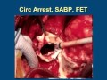 Hybrid approach to aortic arch