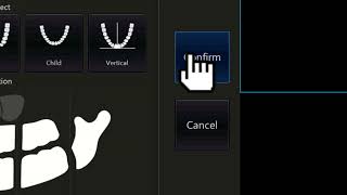 Fussen Dentrix 10 CBCT Software Demo | Easy & Efficient Workflow
