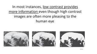 RADS.102 Contrast