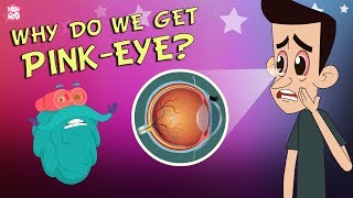 What Causes Conjunctivitis? | CONJUNCTIVITIS | Pink-Eye | The Dr Binocs Show | P