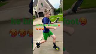 His foot broke