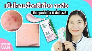 รีวิวครีมซองเซเว่น แป้งโคลนอ็อกซีเคียว ลดผดผื่น ลดสิว Oxe Cure | แนน Sister Nan