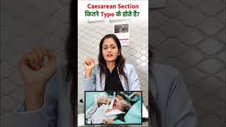 Caesarean Section कितने Type के होते हैं? | Types of C - Section | Dr. Rameet Ahuja | AMMC Hospital