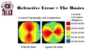 Basics of Astigmatism