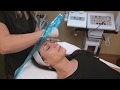 Microneedling - North Idaho Dermatology