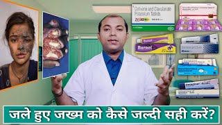 जल जाने पर क्या करना चाहिए | जले हुए जख्म को कैसे जल्दी सही करें | Burn treatment | Jalne ka ilaj |