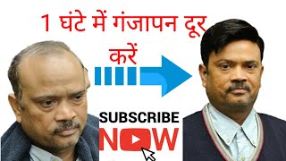 Non Surgical Hair Loss Solution #youtubevideo  @9354535308